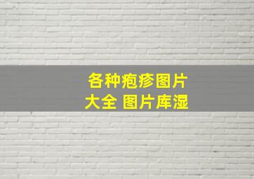 各种疱疹图片大全 图片库湿